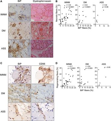 Endoplasmic Reticulum Stress Is Involved in Muscular Pathogenesis in Idiopathic Inflammatory Myopathies